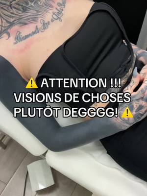 A post by @selena_moondust on TikTok caption: ⚠️ contient des images de cicatrisations dû au detatouage laser ⚠️ dis moi ce que tu penses du resultat final ! Cover final by @Niko Nerdo 🖤 #pourtoi #foryou #fypシ #detatouage #lasertattooremoval #ink #inkedgirl #tattoos #tattoogirl 