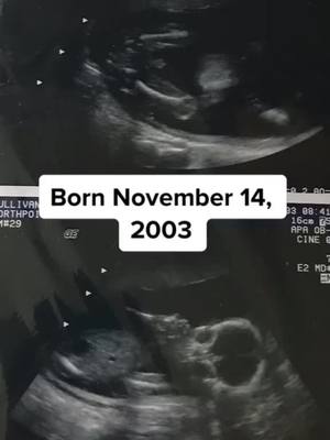 A post by @ftgtfans on TikTok caption: This is where it all began. Ftgt Fans comment what day was the twins born on. #FTGT #Twinz @FTGT 