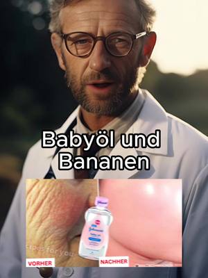 A post by @doktorvarga on TikTok caption: Babyöl und Bananen machen dich zu einem sechzehnjährigen Mädchen, egal wie alt du bist, Falten in deinem Gesicht werden für immer verschwinden #gesundheit #gesund #hausmittel 