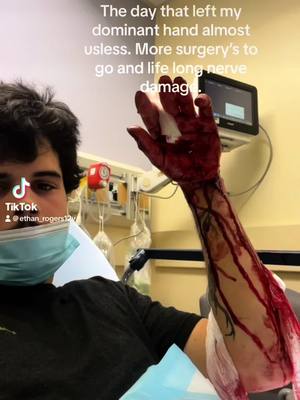 A post by @ethan_rogers12v on TikTok caption: Losing the use of your dominant hand and having severe nerve damage from a work accident i wouldnt wish on anyone. People have gone thru alot worse but this was enough for me. Waking up everyday struggling to make food, eat, shower, dress myself and anytning you can think of. Thank yall for the support more surgery’s to come. #construction #workaccident #fakebloodwarning⚠️ 