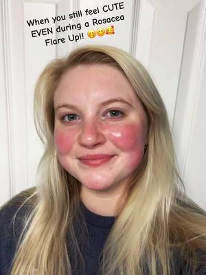 A post by @my_cass.ual_life on TikTok caption: #fyp #fy #foryou #fypシ #foryoupage #foryourpage #fypシ゚viral #fypage #fypp #fyppppppppppppppppppppppp #rosacea #rosaceacheck #rosaceaskincare #rosaceaawareness 