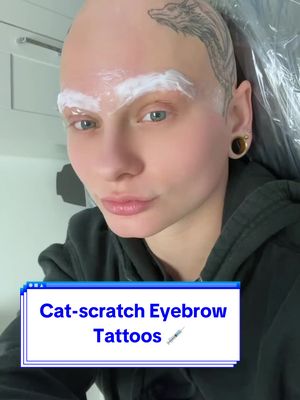 A post by @heythereimshan on TikTok caption: I got my cat-scratch eyebrows tattooed permanently!! 💉🐈‍⬛ I’ve been wanting to microblade my eyebrows since i lost them, but was worried i wouldnt be able to keep my iconic brow slit. My artist @Beauty By Kitten not only KILLED the cat-scratch, but was also kind enough to lend me her services for free in an effort to help me love myseld with alopecia. 🖤 I cannot thank Kitten enough for doing this amazing cat-scratch (no pun intended lol) so please go give her a follow! Lmk if you like the look :) - #microblading #browtattoo #microbladingbrows #eyebrows #brows #tattoos #catscratch #eyebrowslit #tattooing #permanentmakeup #facetattoo #alopecia #bald #hairloss #noeyebrows #alt #alternative #heythereimshannon #shannontaylor #fyp #foryou #foryoupage 