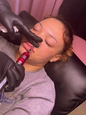 A post by @misslena_marie on TikTok caption: 2ml No Needle Lip Fillers💋🔥🚫💉 #howtodo #DIY #lipfillerbeforeandafter #hyaluronicacidhero #STL #stllashtech #stlhairstylist #lipfillertech #lashextensions #lashtechnician 