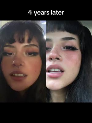 A post by @ll.eyla on TikTok caption: #duet with @Leyla recreated the makeup so I had to remake the video! :)#skin #acne #texturedskin 