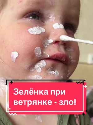 A post by @natysich on TikTok caption: Когда есть, такое чудесное средство, как КАЛАМИН Поверьте, я знаю о чём говорю!  У меня следом переболели 3-е детей и муж 😰 Так вот, были болячки, которые мы намазали ЗЕЛЁНКОЙ и они заживали значительно дольше и с большим раздражением, нежели те, которые были намазаны КАЛАМИНОМ, он есть как крем и как лосьон. Нам больше понравился именно лосьон☝🏼 Он идеально подсушивает и не оставляет после себя следа! И что немаловажно, ни одного рубца не осталось, тогда как были довольно обильные и сильные высыпания!  Второе супер-средство с следующем видео 👉🏼 Или в актуальном ВЕТРЯНКА