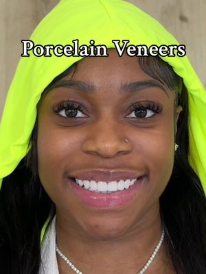 A post by @jessloveme on TikTok caption: Using porcelain to appropriate the spacing, color and contour of the patients natural teeth. 20 porcelain veneers were used to transform this patients smile ✨  DR. JESS  #porcelainveneers 