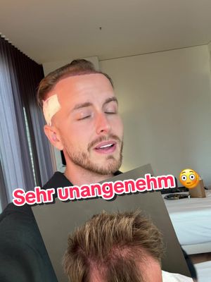 A post by @julienco on TikTok caption: Das kostet mich tatsächlich gerade eine Menge Überwindung, aber ich wollte es trotzdem mit euch teilen 🤍 Ich bin jetzt schon super super happy und kann das Ergebnis kaum abwarten, wie findet ihr es ?  #julienco #haartransplantation 