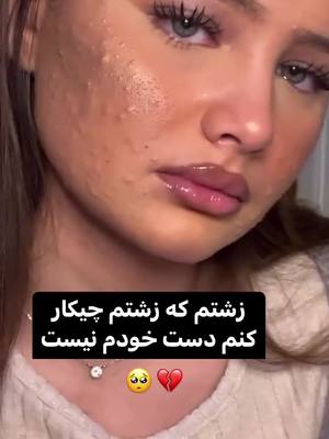 A post by @top.videos.777 on TikTok caption: 😭💔#foryou #foryoupage #fyp #viral #viralvideo #tiktok #viraltiktok #afghanistan #afghanistan🇦🇫 #iran #افغانستان #تیک_تاک_افغانی #افغانی_تیک_تاک #پشتون_تاجیک_هزاره_ازبک_زنده_باد🇦🇫 #پشتون #pakhtoon #explore 