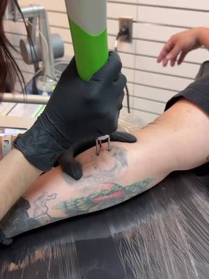 A post by @piercingsbycheli on TikTok caption: Laser tatttoo removal by Paulina.#tattooremoval #tattooremovalspecialists #tattooremovaltreatment #tattooremovalprocess #lasertattooremoval #bye #tattooregret #tattoo#unwanted #baddecisions #breakup #eliminaciondetatuajes #fyp #p #parati #fypシ゚viral #fypage #viral #viralvideo #trending #instagram #inspiration #malasdecisiones #nuncamas #solorecuerdos #dallas #imperioink #@Paulinaaaa 