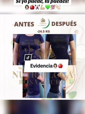 A post by @nutriologa.rosycacho on TikTok caption: Hoy les comparto la evidencia de una de mis pacientes estrellas👩🏻‍⚕️🍎👏🏻✨ 🔴Ella comenzó conmigo en mis inicios de nutrióloga y en un año logramos magníficos resultados. Su disciplina y perseverancia hicieron que lograra su OBJETIVO y logro pasar de tener obesidad a NORMOPESO.  🔴Ella ahora disfruta de buena salud y sigue llevando buenos hábitos saludables, porque como siempre les digo son la clave para tener un peso sano y buena calidad de vida. GRACIAS POR LA CONFIANZA YAZMIN! Sigue en el camino siendo tu mejor versión saludable.💚🙌🏻☺️👏🏻💯 #bajardepeso #perderpeso #perderbarriga #perdergrasa #pesosaludable  🙌🏻💚☺️