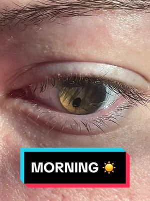 A post by @sagevouivre on TikTok caption: The morning light was just hitting different today 🥰 #eyes #hazeleyes #birthdefect #girlwiththedragoneyes 