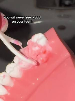 A post by @suyager on TikTok caption: Just £8!!! You will never see blood on your teeth !!!!#uk #amazonfinds #amazonmusthaves #spotlight #tiktokmademebuyit #waterflooser 