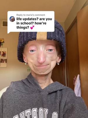 A post by @kaylee_halko on TikTok caption: Replying to @maria life update🩵🩵#fyp #lifeupdate #progeria 