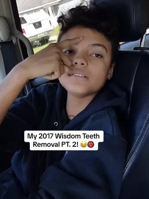 A post by @king_reeses on TikTok caption: Last Part of me coming off Anesthesia from my 2017 Wisom Teeth Removal, I’m a menace 😂💀 #kingreeses #queenreeses #reeses #reesespuffs #reesesnation #wisdomteethremoval #surgery #surgerytiktok #anesthesialife #aftermath #hilarious 