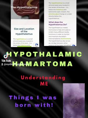 A post by @mysticalmagicalmarie on TikTok caption: Getting to know me! #Youcantonment! #hypothalamichamartoma 