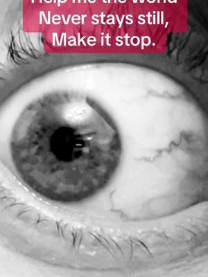 A post by @eyeofthesarcomacancer on TikTok caption: #eyemovement #doctoroftiktok #help #oscillopsia #vision #rare #nystagmusawareness #treatment #eyehealth #stress #annoying 