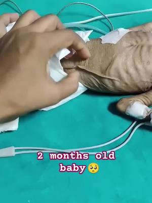 A post by @ped_mohammed.palestine on TikTok caption: 2 Month old baby 🐥