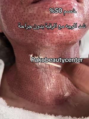 A post by @pakobeautycenter1 on TikTok caption: شد الوجه مع الرقبة بدون جراحة 