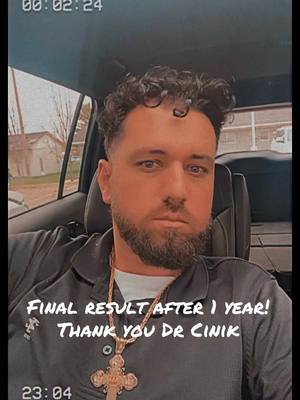 A post by @alekslucic on TikTok caption: #fyp #foryou #viralvideo #drcinik #turkey #hairtransformation #hairtok #hairtransplant #turkeyhairtransplant #istanbul #istanbulhairtransplant #beforeandafter #nohair #balding #baldingsolution 