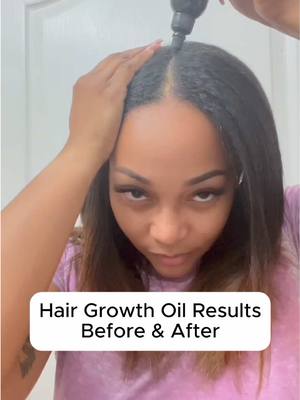 A post by @mykerryberrys on TikTok caption: The hype over our viral hair growth oil is real. Here we grow!😉  #hairgrowthoil #rosemaryforhairgrowth #rosemaryoil #hairlosssolutions #hairgrowthjourney #tiktokshopyearendsale 