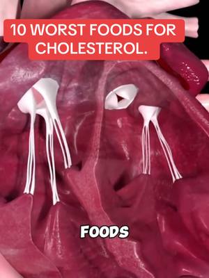 A post by @healthni on TikTok caption: 10 WORST FOODS FOR CHOLESTEROL. #cholesterol #foods #fats #usa🇺🇸 #usa_tiktok #usatoday 