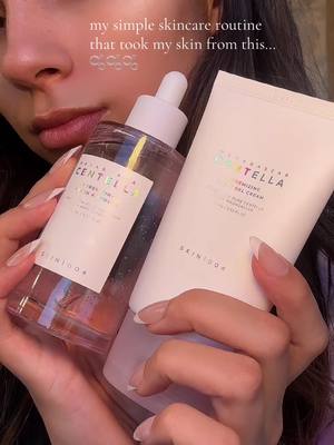 A post by @caitlynisabella on TikTok caption: quality>quantity when it comes to my skincare!!! 🫧 you don’t need a 20 step routine, you just need QUALITY products with clean active ingredients!!! 🫧 🌸🧖🏽‍♀️🫧✨🌸🫧 #skin1004 #centella #pinkampoule #antiaging #peptide #koreanskincare #skincare #pore #poreminimizer #skincaretips #kbeauty #tiktokmademebuyit #skincareroutine @SKIN1004 Official 