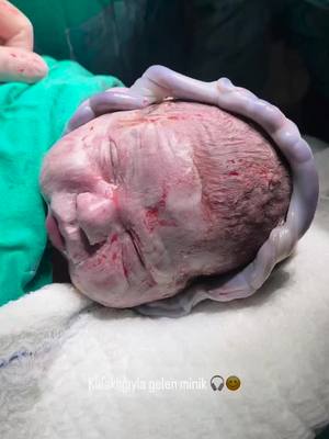 A post by @ped_mohammed.palestine on TikTok caption: Immediately after caesarean section #baby #labou#pregnant 