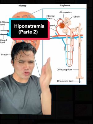 A post by @giovannydecastro on TikTok caption: Hiponatremia Parte 2 #medstudent #estudiantedemedicina #medicina 