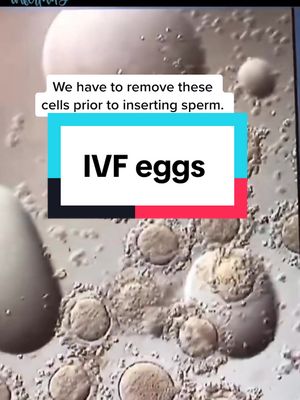 A post by @dr.allison.rodgers on TikTok caption: This is what eggs look like when we first get them.  Going on an egg hunt today! #eggs #ivf #ttc #infertility #fertility 