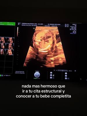 A post by @comecomosars on TikTok caption: Ya entendi eso de que todas las mamas ven a sus hijos hermosos, no puedo dejar de ver las fotos y pensar QUE CHULA MIJA 😍🥰🥰 irreal saber que es un cachito de mi y un cachito de la persona que mas amo