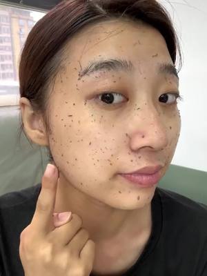 A post by @dimot93 on TikTok caption: For sensitive skin, take a look. This exfoliating ingredient is mild and does not irritate the skin. After use, the face is refreshing, silky and clean. Skin care products are better than absorption. It is more cost-effective to place an order for two now. #skincare #exfoliation #fyp #bodyscrub PH870