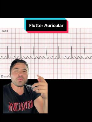 A post by @giovannydecastro on TikTok caption: Flutter auricular #medstudent #medicina #estudiantedemedicina 