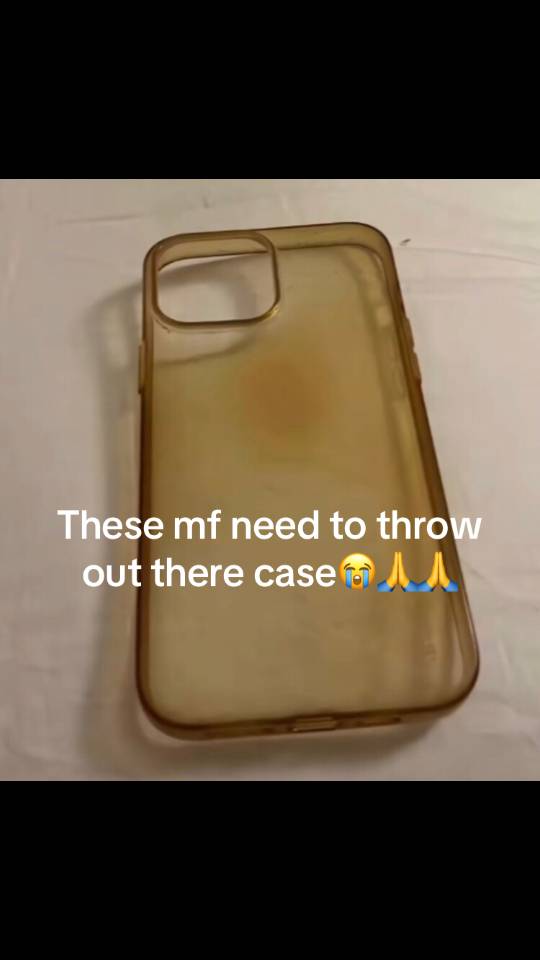 A post by @dripppps1 on TikTok caption: #phonecase#fyp#phone#tag#