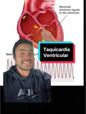 A post by @giovannydecastro on TikTok caption: Taquicardia ventricular #medstudent #medicina #estudiantedemedicina 