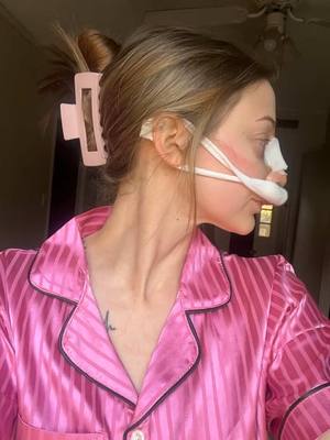 A post by @katherinegoins on TikTok caption: 1 day post-op rhinoseptoplasty. swelling and bruising is getting a bit worse but the pain is more bearable. #rhinoplasty #septoplasty #rhinoseptoplasty #nosejobcheck #deviatedseptum #plasticsurgery #nosejobjourney 