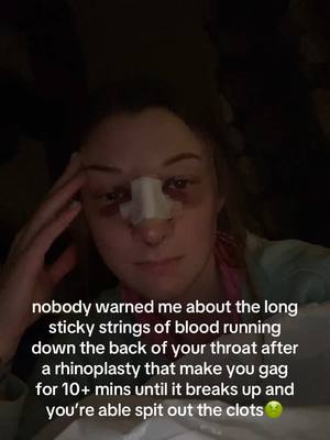 A post by @katherinegoins on TikTok caption: sorry it’s gross, nobody warned me so imma warn yall 🥲 #rhinoplasty #septoplasty #rhinoplastyrecovery #nosejob #rhinoseptoplasty 