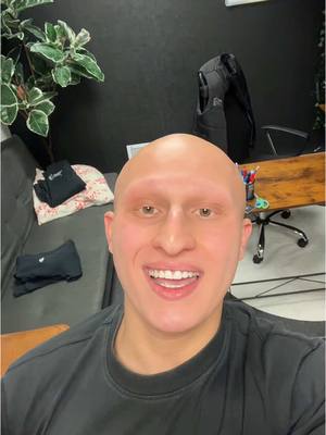 A post by @ken_ahm on TikTok caption: Nouvelle aventure mdrr #alopecie #poils 