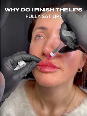 A post by @nataliepageaesthetics on TikTok caption: Did you know symmetry can be affected by gravity during lip injections? 🩶💉  That’s why we perform treatments with clients sitting upright. 	•	Why it matters: Gravity naturally changes facial dynamics when lying down. 	•	Our approach: By injecting while you’re seated, we can assess symmetry in real-time for more balanced results. 	•	The goal: Perfectly aligned lips that look natural from every angle. DM me “Flat Lips” to book in for the next masterclass🫶🏼 ##lipfillers #flatlips  #russianlipsuk #flatlipsuk #russianlipstechnique #flatlipstechnique #lipfillerstraining #russianlipstraining #russianlipslondon #russianlips💉 