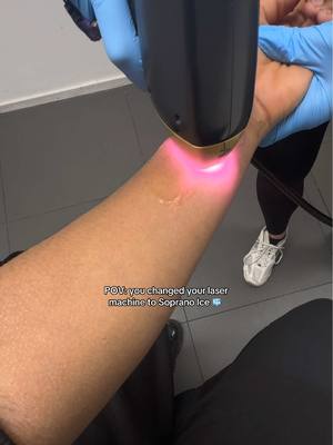 A post by @official.fay_ on TikTok caption: I’ve tried so many for the past 2 years, then I discovered soprano!! it’s been the best for me atm. #laserhairremoval #laserhair #laserhairremovaltreatment #sopranoice #sopranoiceplatinum 