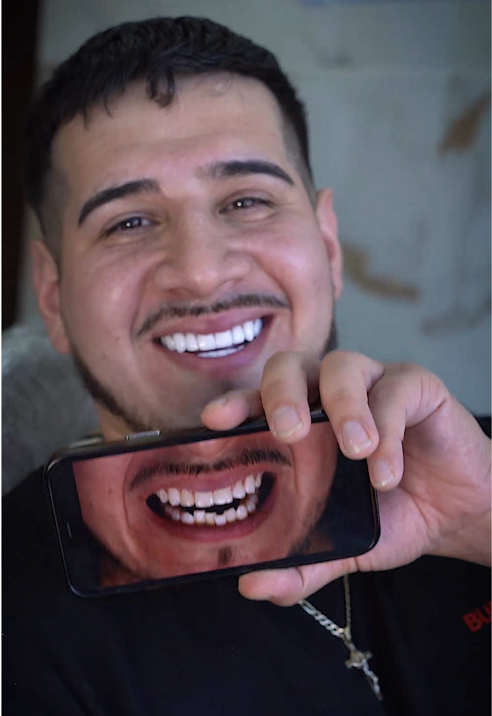 A post by @perfectsmileexperience on TikTok caption: From Chicago 🇺🇸 to Colombia 🇨🇴 for the Perfect Smile 💎  #veneers #porcelainveneers  #veneerscolombia #colombiaveneers #medellin #colombia #perfectsmile #dentallab #dentallaboratory #perfectsmileexperience #colombiadentist #bestveneers #dentist #cosmeticdentistry 