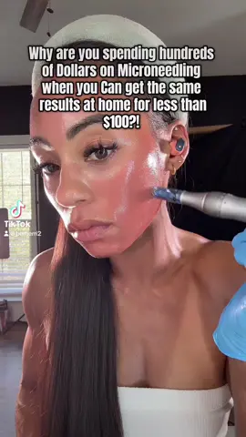 A post by @bemerri2 on TikTok caption: #microneedleathome #microneedlingface #microneedle #microneedlingathome #athomemicroneedle #creatorsearchinsights 