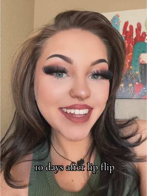 A post by @dom_.unique_ on TikTok caption: Honestly I love it🤍 #lipflipresults #lipflip #lipflipcheck #botoxcheck #botox 