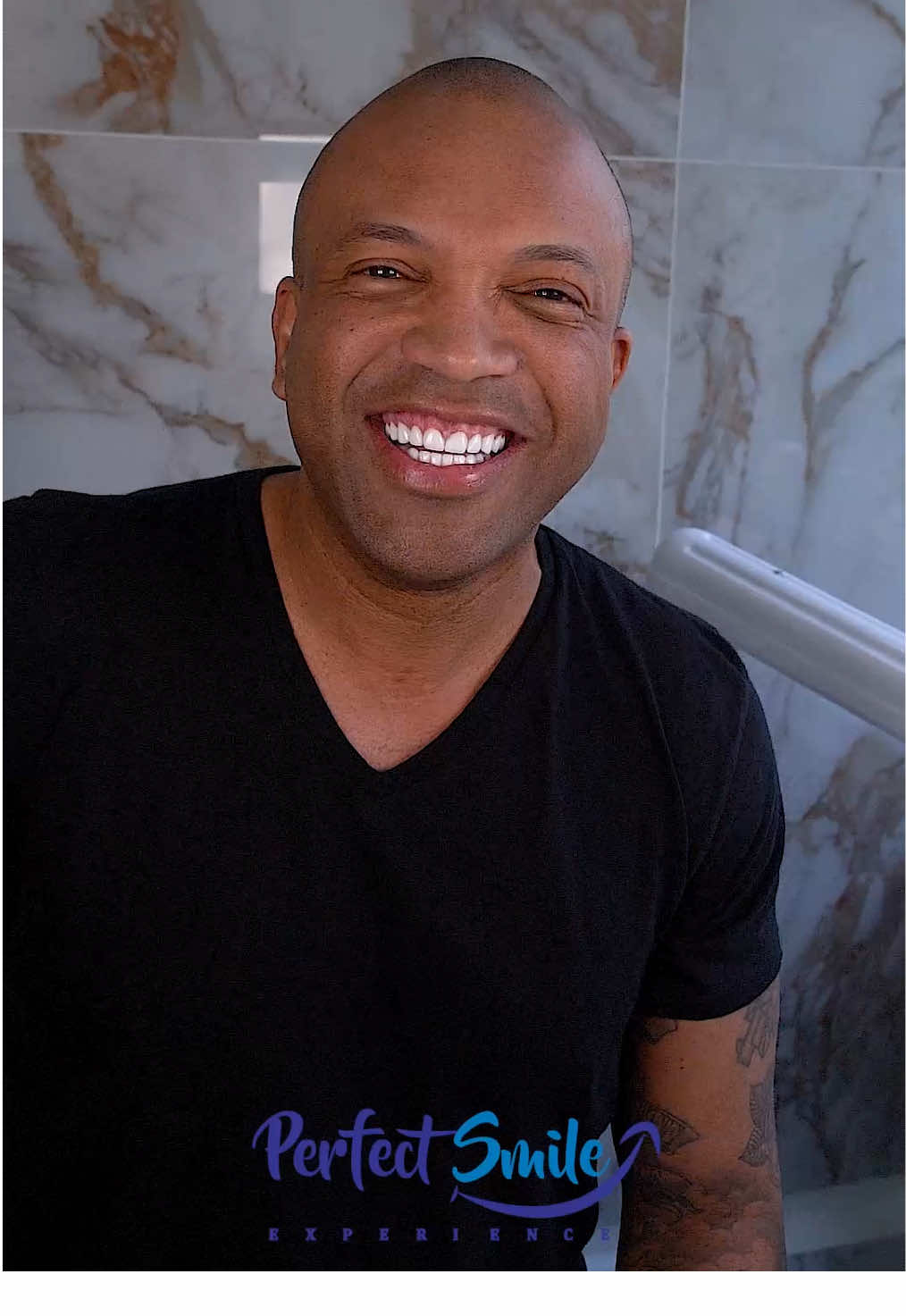 A post by @perfectsmileexperience on TikTok caption: Welcome to the new and improved @coffeyanderson 🤠💎. . •100% Porcelain Veneers •Completed in 3-4 days •Can last approximately 15-20 years •Minimal shaving in most cases •English Speaking staff •Travel package and concierge services available to plan your stay •Amazing Quality and prices! .  #veneers #porcelainveneers  #veneerscolombia #colombiaveneers #medellin #colombia #perfectsmile #dentallab #dentallaboratory #perfectsmileexperience #colombiadentist #bestveneers #dentist #cosmeticdentistry 