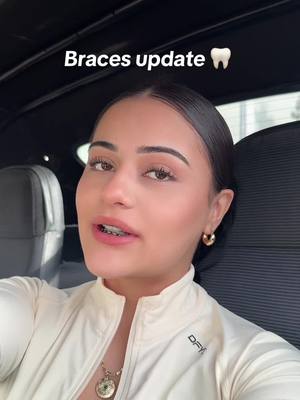 A post by @evelynomadera on TikTok caption: Braces update 🦷 give me opinions #fyp #braces 