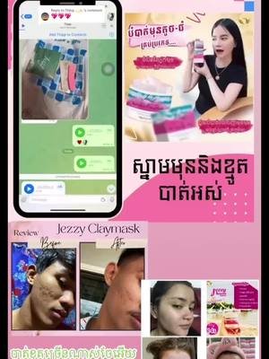 A post by @jezzy8888 on TikTok caption: Replying to @Thīng 💫🤟🏻 បិតម៉ាសត្រូវបាត់មុន ស្នាមខ្មូតចឹង☺️💕 #zyxbca #jezzyclaymask 