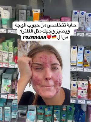 A post by @almaz._tcherk on TikTok caption: #ex #explore #explor #dm #rossmann #حبوب_الوجه #care #حبوب #skincare #akne #beauty #germany #deutschland 