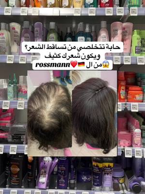 A post by @almaz._tcherk on TikTok caption: #ex #explore #explor #dm #rossmann #تساقط_الشعر #المانيا_السويد_النمسا_النروج_دينيمارك #تساقط_الشعر_وعلاجه #تساقط #تساقط_شعر #عناية #المانيا #المانيا🇩🇪 #عناية_بالشعر 