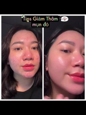 A post by @heeyoung126 on TikTok caption: + Tips serum trắng da Gái hàn RW dùng nhìu young dạo gần đây. Chân ái cho da tàn nhan, thâm mụn nhìu nak 9 Lo: #beautytips #Oder_Mỹ_phẩm_Hàn #skincarereview #xuhuong #cuocsongohanquoc #glow