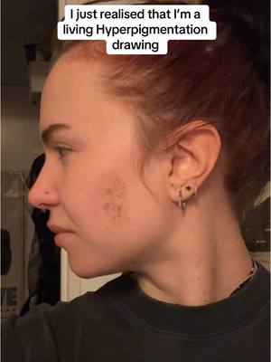 A post by @sexytigerpaw on TikTok caption: My destiny 💜 #hyperpigmentation  