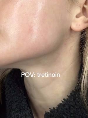 A post by @yourblondegaby on TikTok caption: If ya know ya know #tretinoin #skincare #retinol #retinoid  